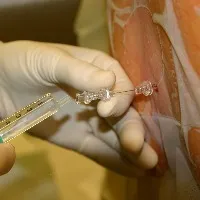Yadadri Govt Doctors Left Women In Middle Of Family Planning Operation