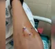 Angry lecturer bites student for cheating during examination