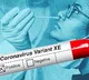 XE variant or not Maharashtra reports first case Centre disagrees