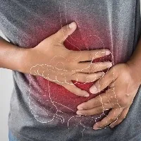Watch your weight fluctuations risk rises colon cancer