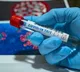Eight people tested covid positive in AP