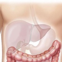 How high-intensity exercise can benefit fatty liver disease patients