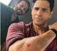 Siddharth Malhotra injured in shooting