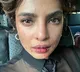Priyanka Chopra shares picture of 'bruised' face from 'Citadel' set
