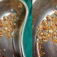 206 kidney stones removed from man in Hyderabad