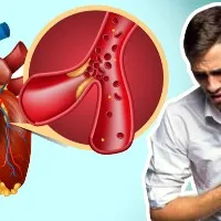What is myocardial infarction