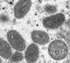 WHO says physical contact is primary route for Monkeypox transmission