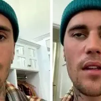 Justin Bieber says he is suffering from facial paralysis