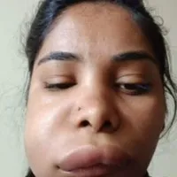 Kannada heroine face changed after root canal treatment