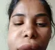Kannada heroine face changed after root canal treatment