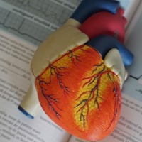 Why heart attacks in women are often missed