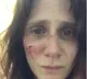 Victim of domestic abuse, French actress posts shocking pics on Instagram