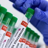 Monkeypox spreads to over 60 countries India sees 1st case