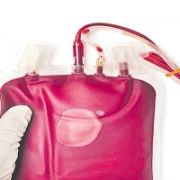 Long Covid sufferers in Europe seeking experimental 'blood washing' in Germany