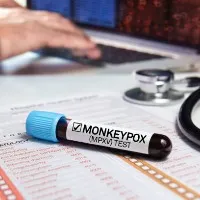 No Monkeypox to Vijayawada toddler