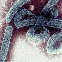 WHO on alert as deadly 'Marburg' virus comes to light in Africa's Ghana