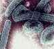 WHO on alert as deadly 'Marburg' virus comes to light in Africa's Ghana