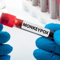 After Covid hiatus, monkeypox fears haunt K'taka district