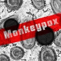 WHO declares world health emergency on Monkeypox spreading