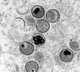 Delhi Man Tests Positive For Monkeypox