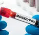 Monkeypox outbreak can be stopped says WHO official
