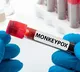 Indias first monkeypox death in kerala