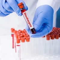 Japan approves smallpox vaccine to prevent monkeypox