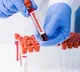 Japan approves smallpox vaccine to prevent monkeypox