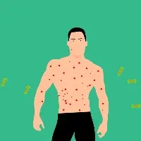 Dos and Donts amid Monkeypox virus spreading