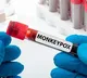 Suggest new name for MonkeyPox asked WHO