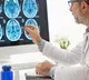 Risk of developing dementia brain fog remain even two years after contracting Covid19