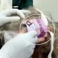 Head Wound Dressed With Condom Pack At Madhya Pradesh Health Centre