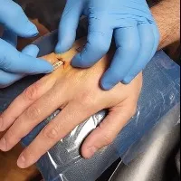 Man implants his tesla car key in his hand