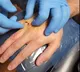 Man implants his tesla car key in his hand