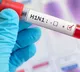 Swine flu strikes again after 3 years in Hyderabad