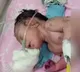 Baby born with horn like structure instead of legs in Madhya Pradesh