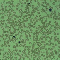 Thalassemia Sickle Cell Society (TSCS) receives 200000th blood units as of today