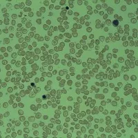 Thalassemia Sickle Cell Society (TSCS) receives 200000th blood units as of today