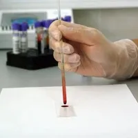 Scientists develops new blood test that can detect multiple cancers