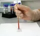 Scientists develops new blood test that can detect multiple cancers