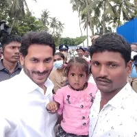 CM Jagan grants one crore rupees to Baby Honey who is suffering with rare decease