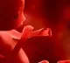 Toxic air pollutants found in lungs brains of unborn babies