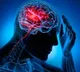 Early signs of brain stroke