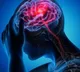 Find these symptoms that indicates Brain stroke early