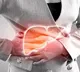 Fatty Liver Disease Signs That Can Indicate Severity