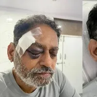 stampade in Rahul gandhi Bharath jodo yatra