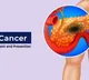 Pancreatic cancer could be diagnosed up to three years earlier new study