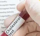What causes behind High cholesterol risk