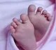 Infant born with rare deformity in Bihars