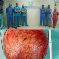 Doctors at Hyderabad hospital remove football-sized kidney tumour